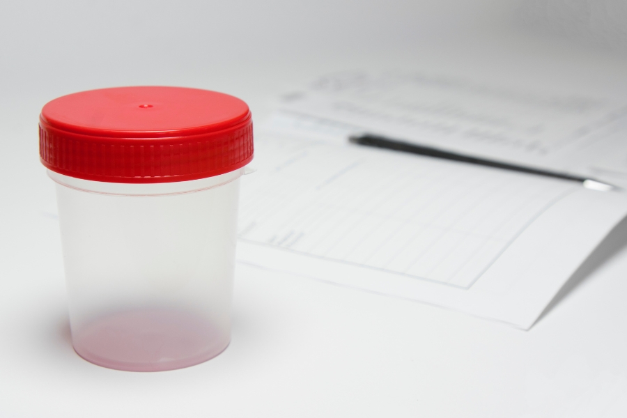 Microscopic Hematuria